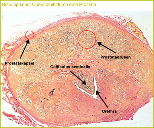 Histologischer Querschnitt durch eine Prostata